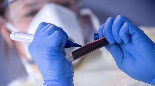 Lübnan'da da mutasyona uğramış korona vakası görüldü