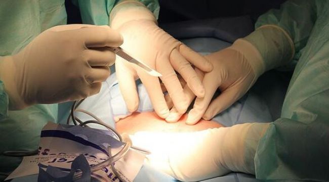 Organ nakli sayısı salgın nedeniyle azaldı