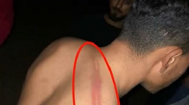 Yunan askerleri ölüme terk etti, Mehmetçik kurtardı