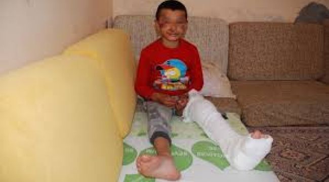 8 YAŞINDAKİ ÇOCUK ÖLÜMDEN KIL PAYI KURTULDU