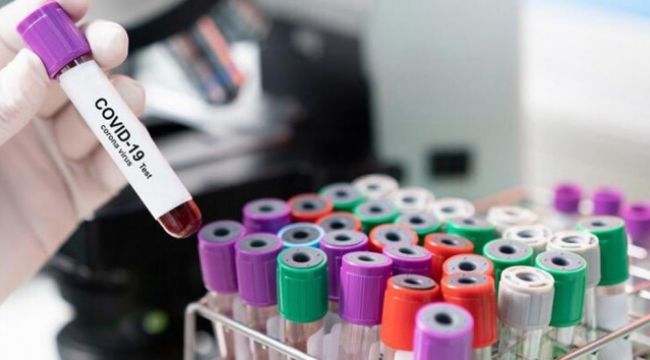 Bulgaristan'da açılma kararından sonra Covid-19 vakaları arttı
