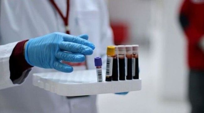 İsrail'de Covid-19'a karşı alınan önlemler hafifletiliyor