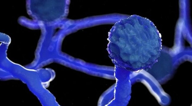 Hindistan'da Covid: Bazı hastalar ‘kara mantar’ nedeniyle görme yetilerini kaybediyor