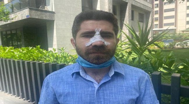 Kadıköy'de aile hekimine saldırı