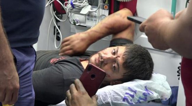 Tüfekle vuruldu, 1 kilometre yürüyüp arkadaşlarından yardım istedi