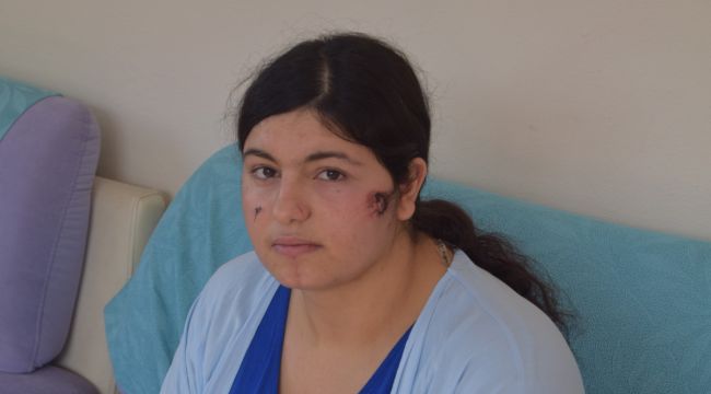 EŞİNDEN ŞİDDET GÖREN KADIN KONUŞTU