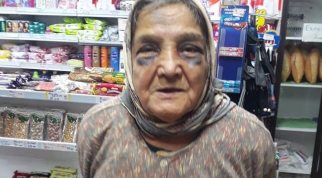 Demir çubukla dövdüğü 73 yaşındaki eşini, bakın ne hale soktu