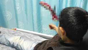 10 yaşındaki çocuğun kafasına makas saplandı 
