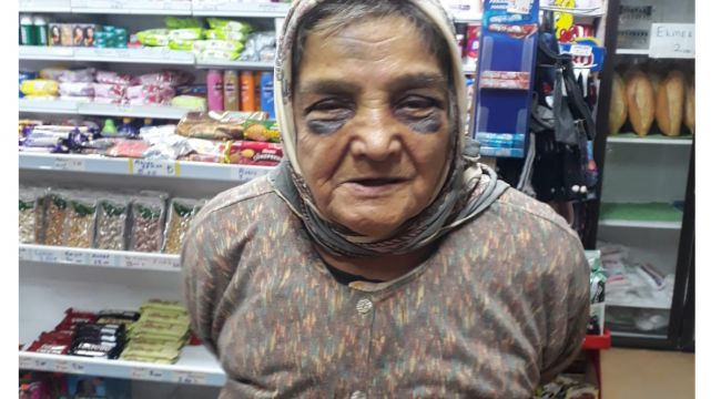 Demir çubukla 73 yaşındaki eşini döven adam hakkında yasal işlem başlatıldı