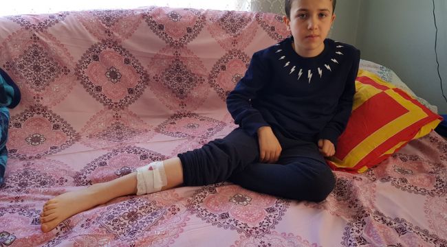 Sokak köpekleri bir çocuğa daha saldırdı