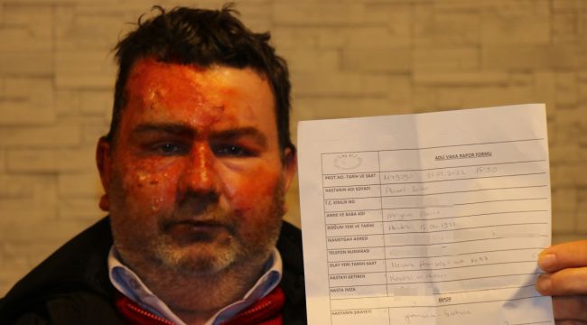 Uyurken dehşeti yaşadı