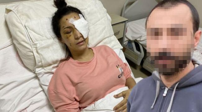 'Ağabey' demeyen yengesini 37 yerinden bıçaklayıp kör etti