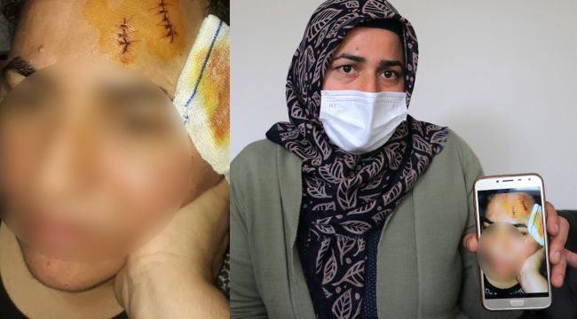 Komşuya tencereli darp