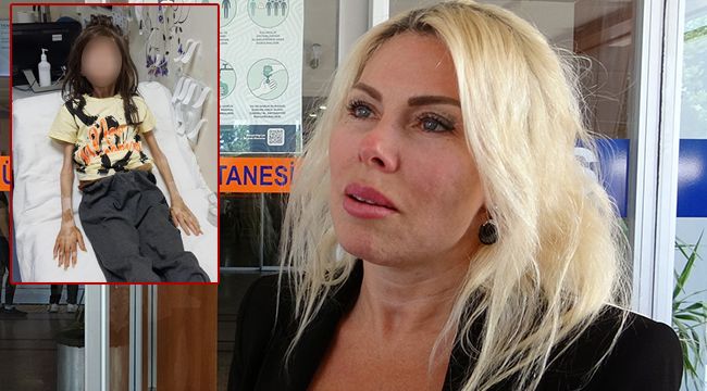 Rektör Özkan: 'Muhammet'in İştahı yerinde, tedavi olur olmaz eğitimine başlanacak'