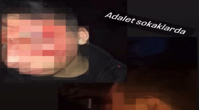 Ereğli'de lisede darp görüntülerini çeken öğrenci saldırıya uğradı