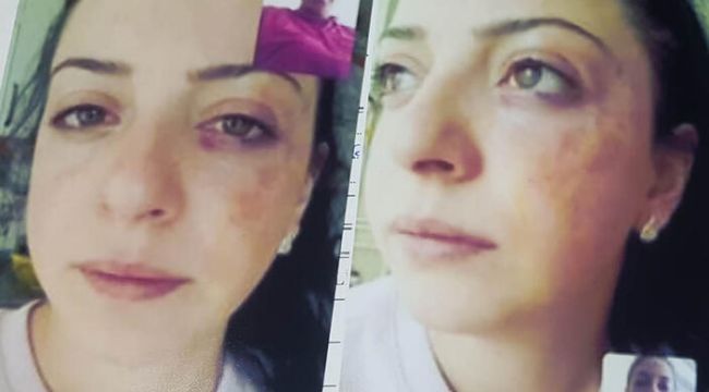 Boşanma aşamasındaki Fadimana’dan ziynet ve ev eşyalarının iadesi için hukuk mücadelesi