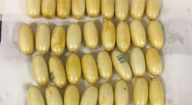 Midesinden 50 kapsül kokain çıktı