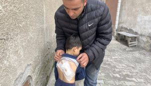 4 yaşındaki çocuğa sokak köpekleri saldırdı