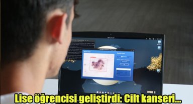 Lise öğrencisi geliştirdi:Cilt kanseri...
