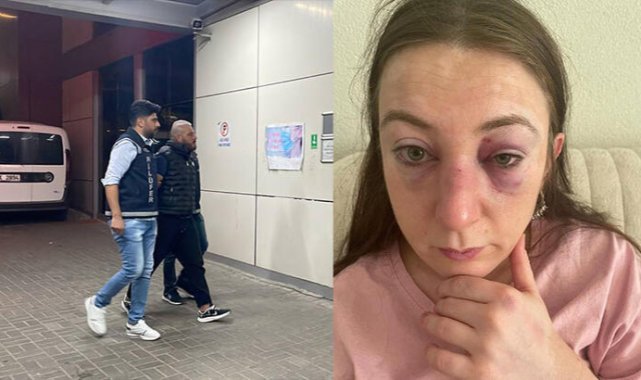 Sibel'i dövüp, ölümle tehdit eden eski sevgilisi yakalandı