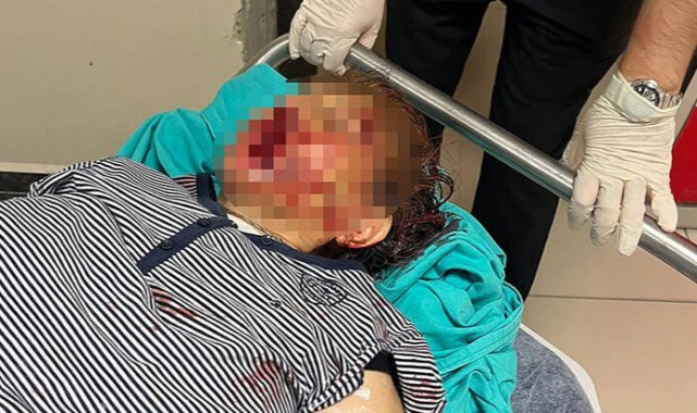 Tartıştıkları torunları demir kürek ile darbetti