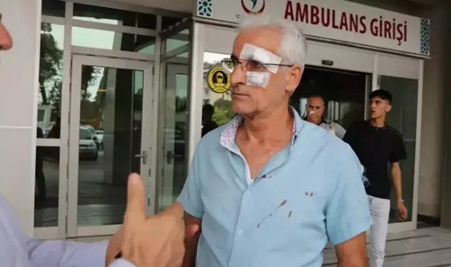 Park kavgasında taksici, öğretmeni dövdü