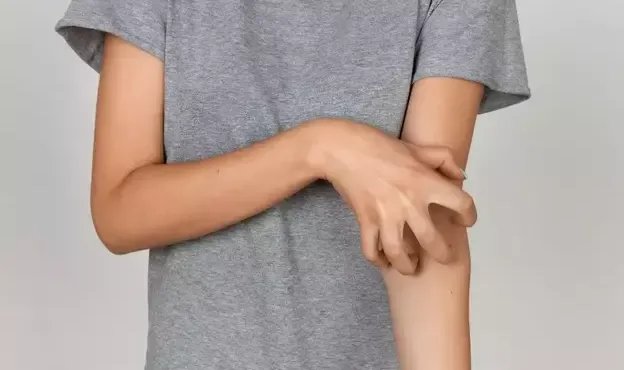 Uyuz hastalığından korunmak için dikkat edilmesi gerekenler