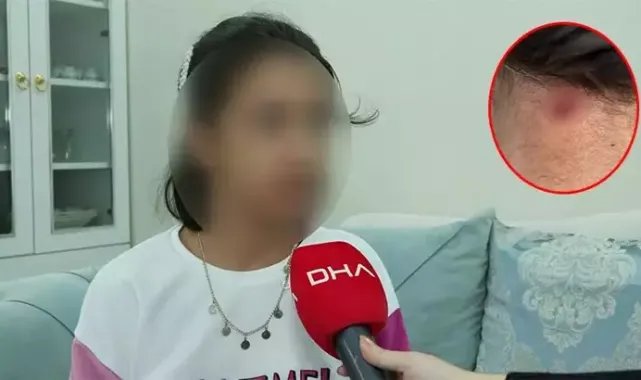Bahçelievler'de maganda kurşunu 11 yaşındaki kızın boynuna isabet etti
