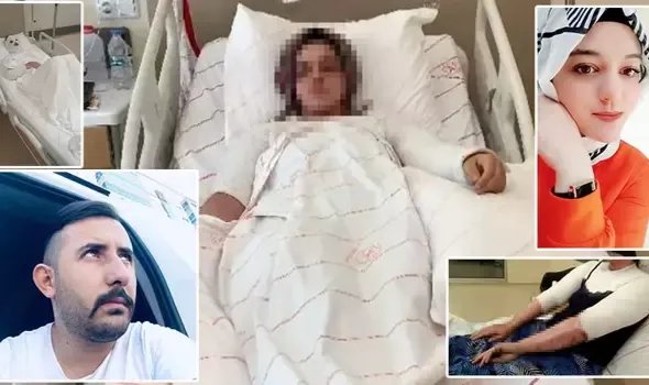 Eski nişanlının yüzüne kimyasal atmaya 15 yıl hapsin gerekçesi: Canavarca hisle yapıldı