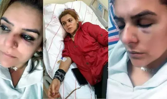 Roman ailelerin fahri koordinatörü dövüldü