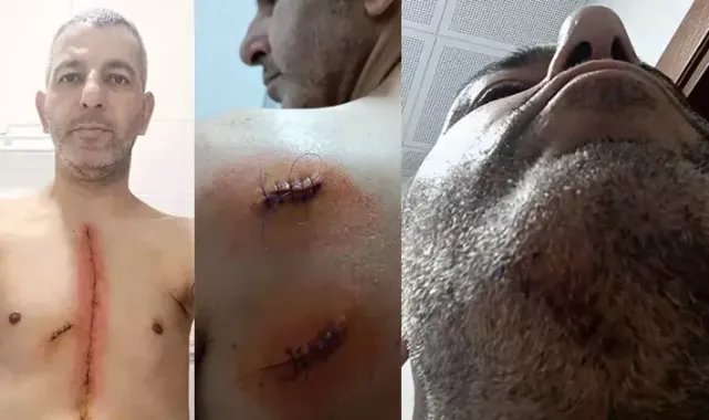Tartışan çifte müdahale edince bıçaklandı: Kimseye yardım edemiyorum