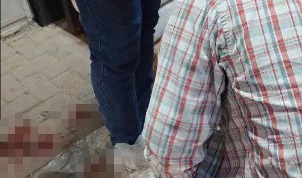 Aracı kurşunlanan vatandaş, şimdi de silahlı saldırıya uğradı