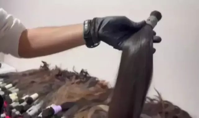 Esenyurt'ta protez saç operasyonu