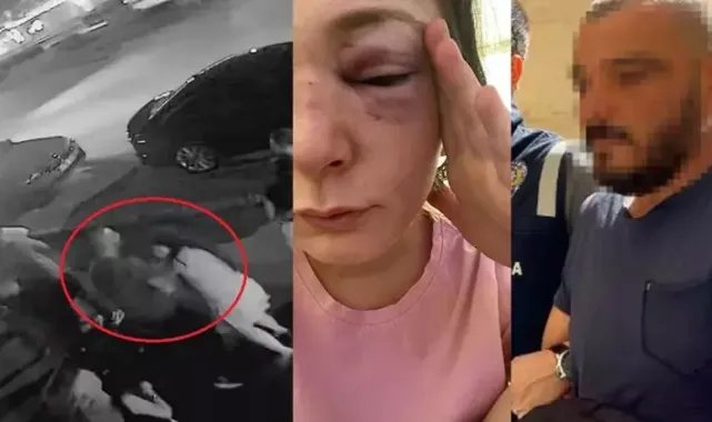 Eski sevgilisi Sibel&#039;in vücudunda sigara da söndürmüş