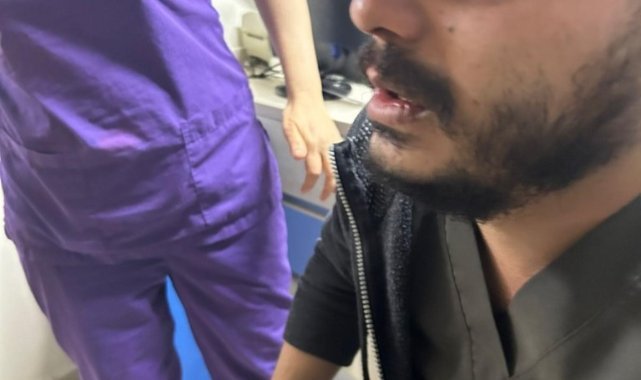 Gaziantep’te hasta yakınları tarafından darp edilen doktorun burnu kırıldı