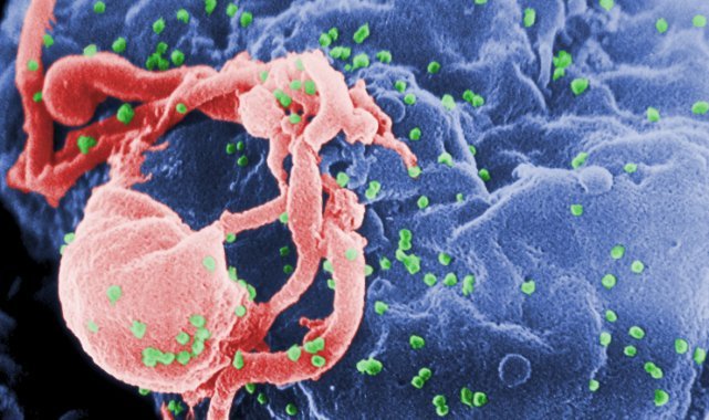 Bilim insanları, hücreden AIDS’e neden olan HIV virüsünü makas gibi kesip attılar