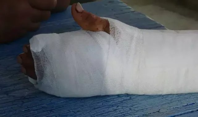 72 yaşındaki çoban, başıboş köpek saldırısında yaralandı