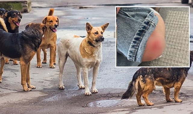 Ankara’da 15 yaşındaki çocuğa sokak köpekleri saldırdı