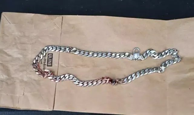 ABD’de boynundan vurulan bir kişi ‘zincir kolyesi’ sayesinde kurtuldu