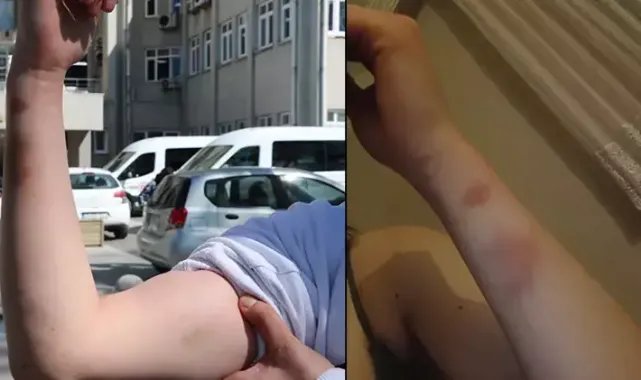 İlişki isteğini reddeden sevgilisini darbeden şüpheliye 3 yıla kadar hapis istemi