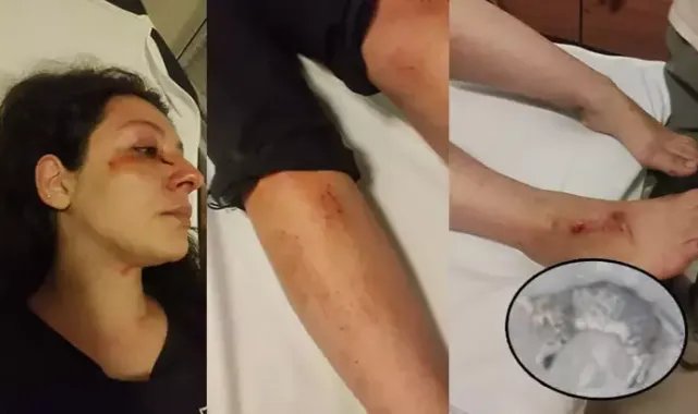 Anne ile kızı, kedilerini öldürdüğünü iddia ettiği baba-kız tarafından darbedildi