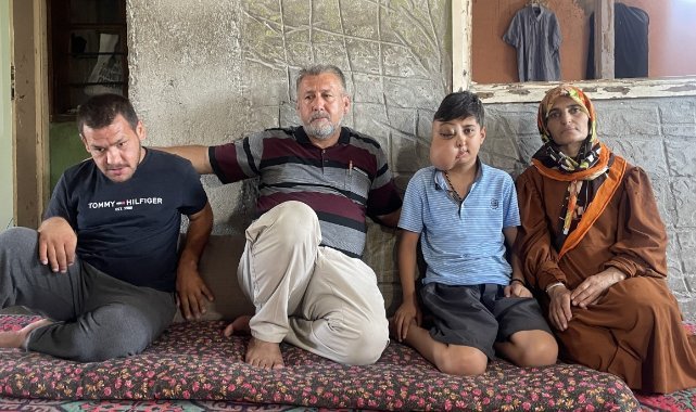 İki farklı yüzü var gibi görünen çocuğun tek isteği iyileşip gülmek