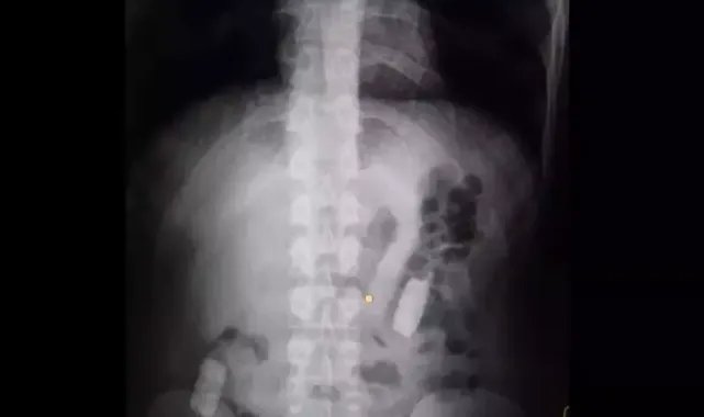 Midesinde taşıdığı 1 kilo uyuşturucuyla yakalandı