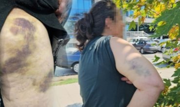 Eşiyle kavga eden eski yengesini darbetti