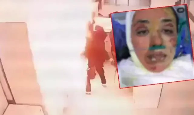 Hastanede patlamada yaralanan Gizem hemşire: Hemşire arkadaşımız çakmağı yakarak sebep oldu