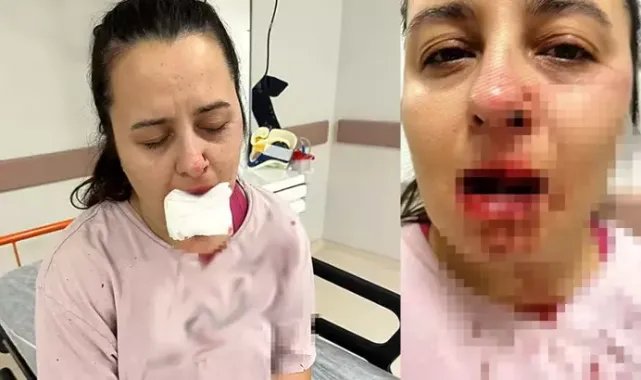 Balyozla saldırdığı yeğeninin çenesini ve 1 dişini kırdı