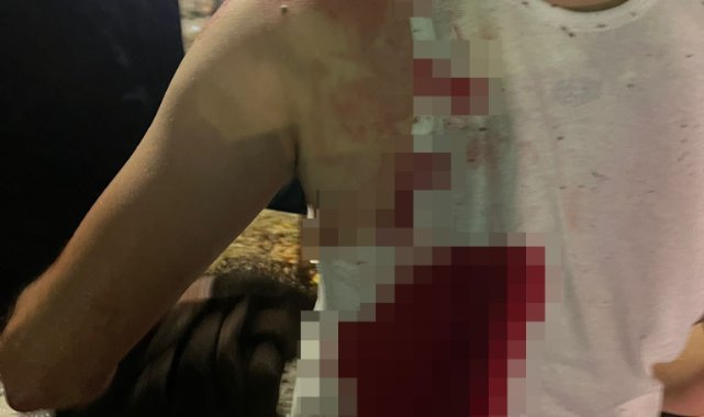 Biriken çöpleri toplayan işçi sırtından bıçaklandı