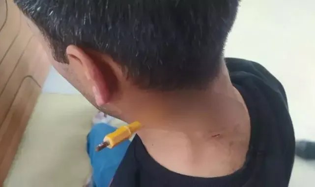 Esenyurt'ta park yeri kavgasında boynuna tornavida sapladı