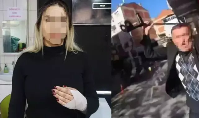 Kiracısına bastonla saldıran iş yeri sahibine 30 gün uzaklaştırma