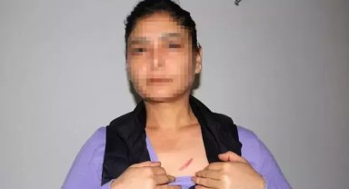 Daha önce evinin kapısını yaktığı kadını, elektrikli düzenekle öldürmeye çalıştı